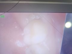 -土豆口腔(凤凰北总店)