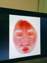 -成都西区医院整形美容