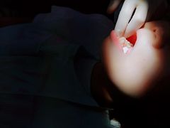 -柏乐口腔(南宁总院)
