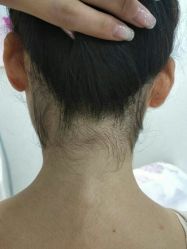 -薇兰专业脱毛连锁机构