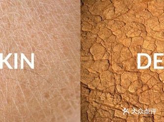 洗澡流汗都可能致命，对水过敏怎么办！？