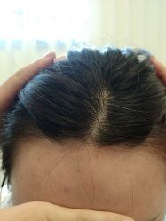 -熙朵美学植发·连锁品牌