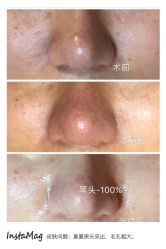 光SPA水氧＋opt-光SPA科技美肤