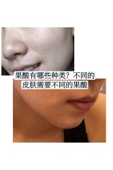 -八大处整形