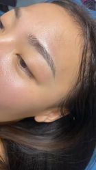 体验后-重庆联合丽格第五医疗美容医院