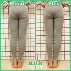 -FACE·日本小颜矫正美容整骨サロン