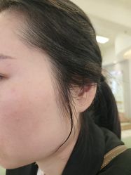 -长沙雅美医疗美容医院