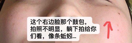 体验后-北京炫美医疗美容
