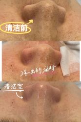 -MLP美丽派·问题肌疗愈中心