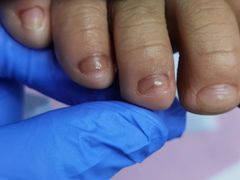 -Andrew指甲专科灰指甲·甲沟炎矫正·3D步态矫形鞋垫定制(上海法华镇路旗舰店)