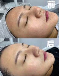 -苗方清颜痘肌研究所