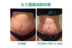 -Fundi张玉珊修身堂·indiba·BTL科技瘦身