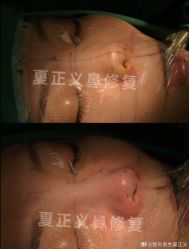 -北京米扬丽格医疗美容·联合丽格鼻整形中心