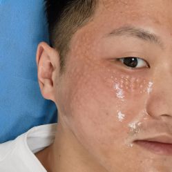 体验后-哈尔滨瑞丽医疗美容医院