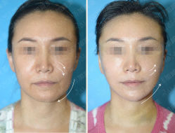 -加减美医美连锁品牌