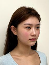 -Yestar重庆艺星医疗美容医院