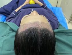 -熙朵美学植发·连锁品牌