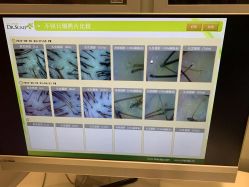 -LESSMORE科技头皮理容中心