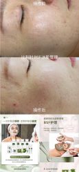 -E.beauty驻颜·痘敏肌调理中心