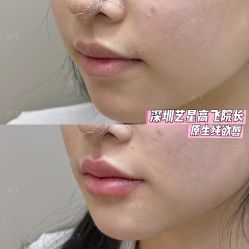 -深圳艺星医疗美容医院