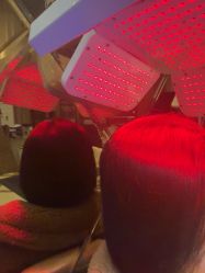 -碧莲盛·不剃发植发