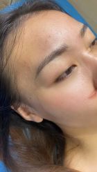 体验后-重庆联合丽格第五医疗美容医院