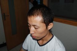 -大麦微针植发丨全国连锁