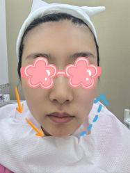 体验后-Dr.U博士医疗美容医院
