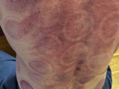 -沈师傅盲人按摩工作室(密三小区店)