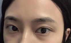 -素美医疗美容·西南眼鼻整形·修复基地