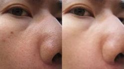 -Cream88颜皮肤管理中心