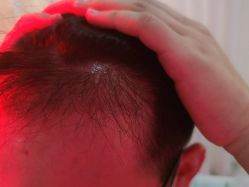 -新生植发·植养护一体