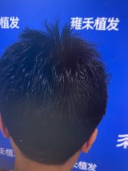 -雍禾植发全国连锁