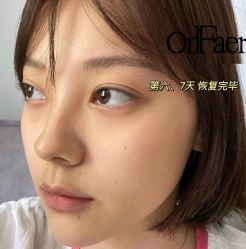 -OnFaer.纹眉半永久无创洗眉