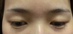 -西施无菌半永久纹绣眉眼影唇轻增发纹发际线