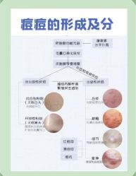 -苗方清颜痘肌研究所