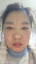 -烟台曙光医疗美容医院