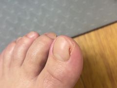 -郑远元专业修脚房(栖山路店)