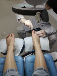 -派恩宜灰指甲鸡眼嵌甲手足癣