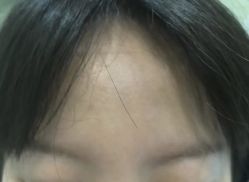 -郡艺医疗美容·微整·眼鼻吸脂