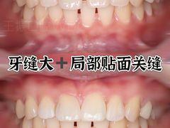 -绿地·中山里