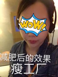 -摩瘦纤体订制减肥