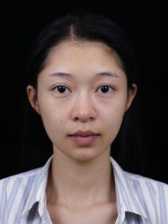 体验后-南宁华美医疗美容医院