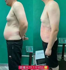 -苗塑堂减肥艾灸