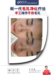 -靓芙泉专研痘痘肌