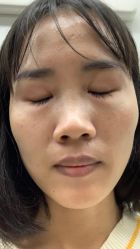 体验后-南宁华美医疗美容医院