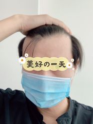 点击看大图 -大麦微针植发全国连锁