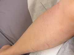 -承启堂中医馆·推拿·针灸(成华馆)