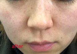 -美莱医学美容医院