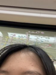 -悟空祛痘·诺奖技术专业店